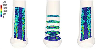 Turbulent Systolic Flow Downstream of a Bioprosthetic Aortic Valve: Velocity Spectra, Wall Shear Stresses, and Turbulent Dissipation Rates